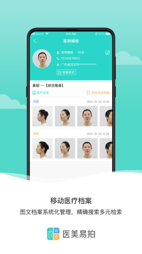 医美易拍截图